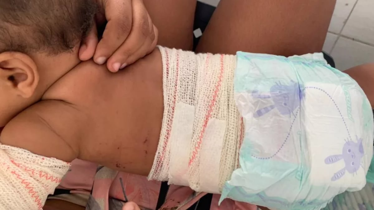 O rojão acabou atingindo o interior de um cesto, onde estava deitada uma bebê de 6 meses. Por conta disso, a criança teve algumas queimaduras. (Foto: Divulgação/PC)