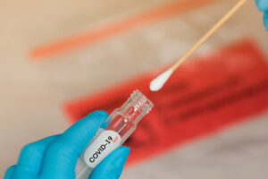 Veja onde fazer o teste da covid-19 em Goiânia nesta segunda-feira (7)