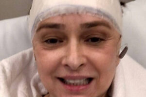 Myrian Rios recebe alta após cirurgia na cabeça para retirar próteses