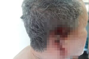 Preso suspeito de cortar a orelha do patrão por causa de adiantamento de R$ 20, em Jaraguá