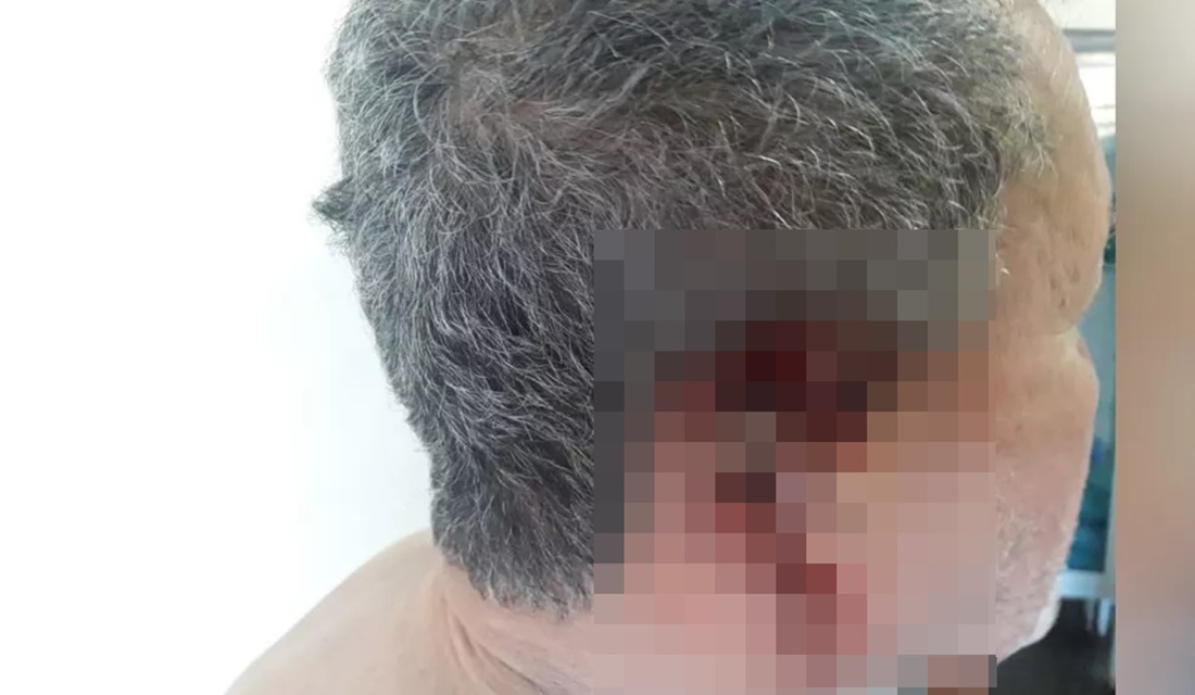 Preso suspeito de cortar a orelha do patrão por causa de adiantamento de R$ 20, em Jaraguá