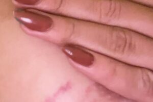 Atriz Marcella Maia mostra denuncia transfobia e mostra hematomas 1