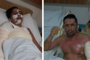 Família sofre queimaduras graves ao cozinhar com álcool, em Anápolis — Foto: Arquivo Pessoal/Benta Correa