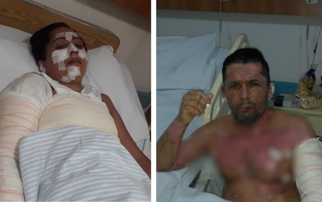 Família sofre queimaduras graves ao cozinhar com álcool, em Anápolis — Foto: Arquivo Pessoal/Benta Correa