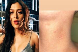 Atriz Marcella Maia mostra denuncia transfobia e mostra hematomas