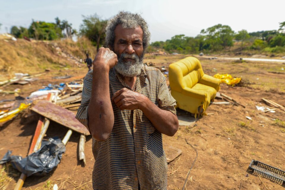 Homem mostra o braço onde foi atacado por policiais