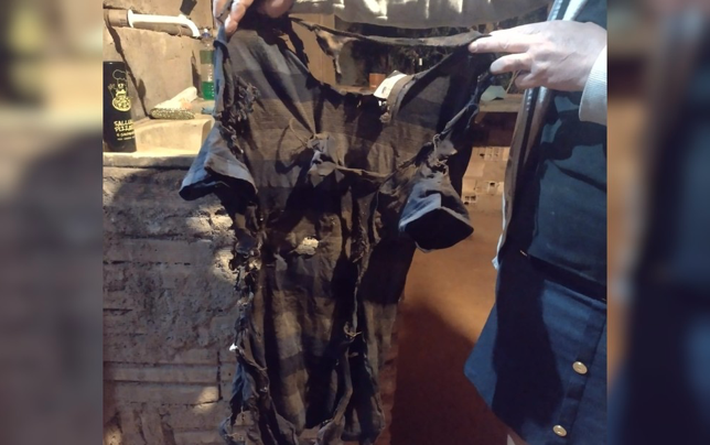 Camisa de Israel Rosa após explosão com álcool, em Anápolis — Foto: Arquivo Pessoal/Benta Correa