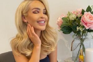 Katie Piper foi agredida em 2008 a mando de um ex-namorado. Apresentadora atacada com ácido rebate acusação de excesso de botox