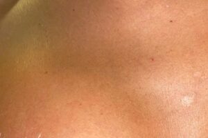 Atriz Marcella Maia mostra denuncia transfobia e mostra hematomas 3