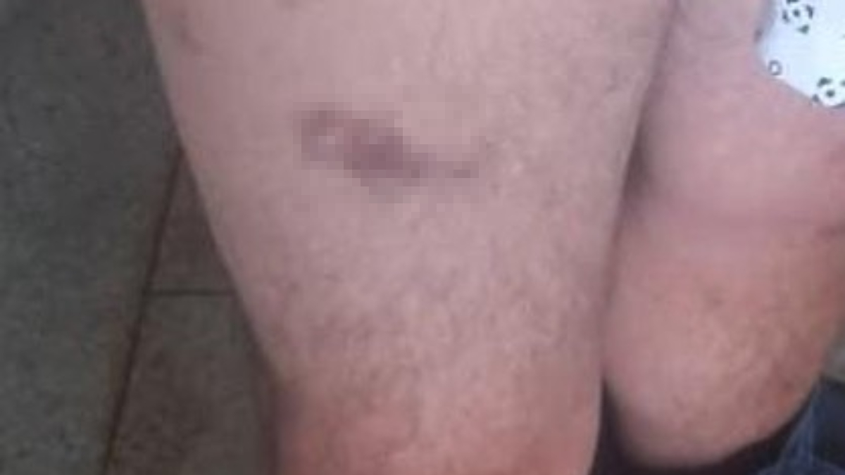 Dependentes químicos denunciam agressões em clínica de reabilitação em Valparaiso