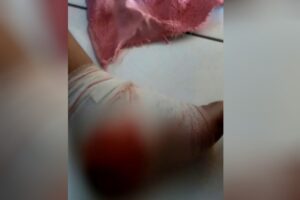 Secretário de Damolândia é baleado no pé depois de desentendimento com a PM