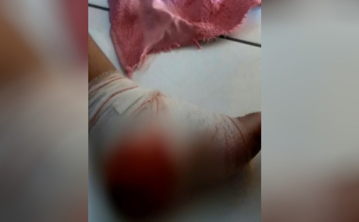 Secretário de Damolândia é baleado no pé depois de desentendimento com a PM