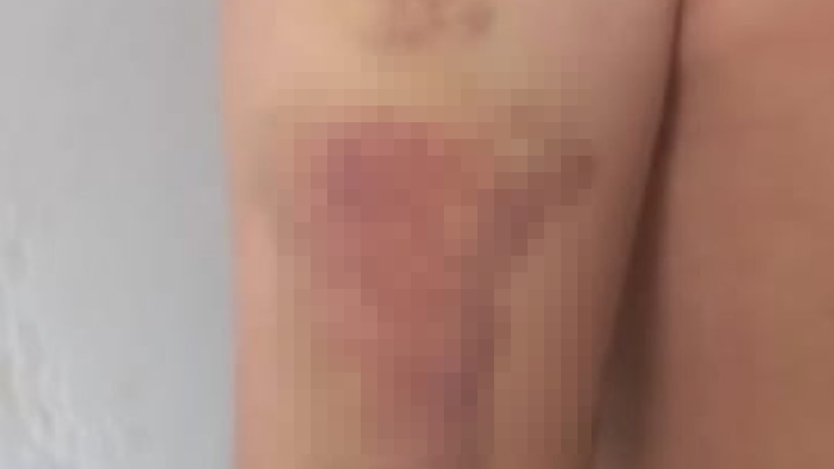 Dependentes químicos denunciam agressões em clínica de reabilitação em Valparaiso