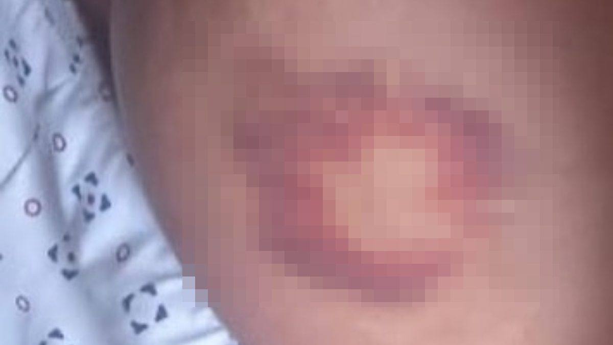 Dependentes químicos denunciam agressões em clínica de reabilitação em Valparaiso