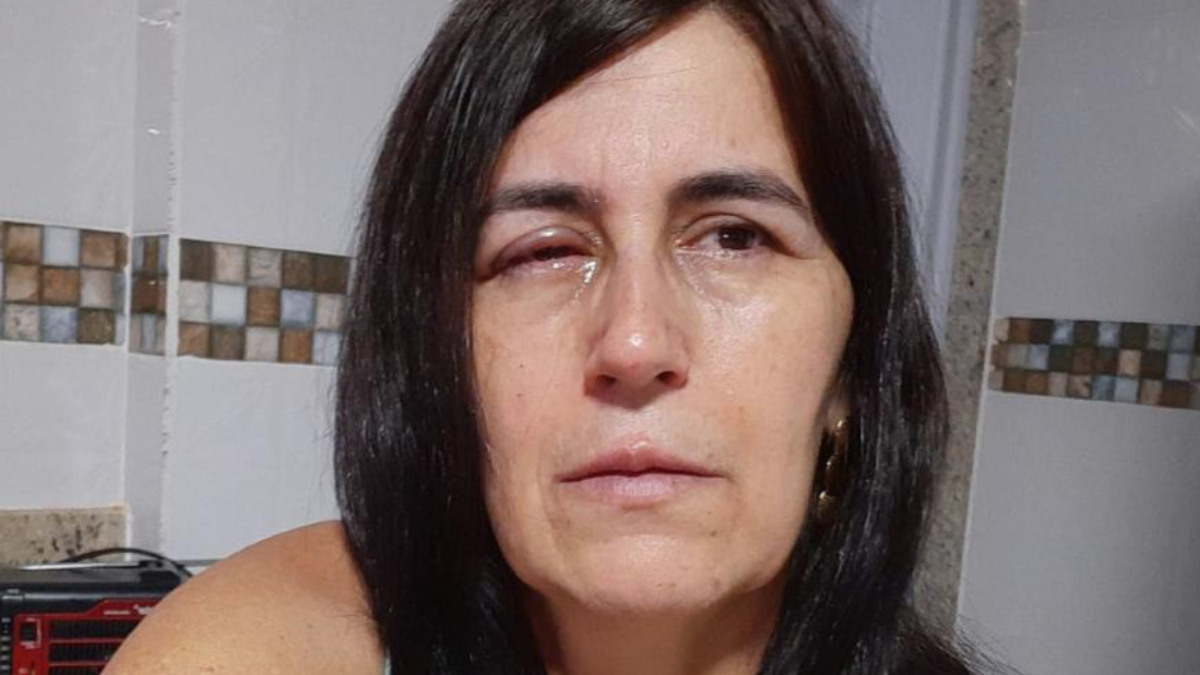 Mulher é socorrida após confundir supercola com colírio, no ES