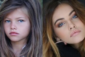 Garota "mais bonita do mundo" em 2007 vive drama de saúde aos 20 anos (Fotos: Instagram)