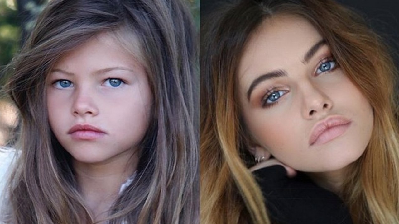 Garota "mais bonita do mundo" em 2007 vive drama de saúde aos 20 anos (Fotos: Instagram)