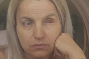 Uma empresária residente em Minaçu denuncia que ficou cega de um olho depois de passar por uma cirurgia estética nas pálpebras. (Foto: reprodução/TV Anhanguera)