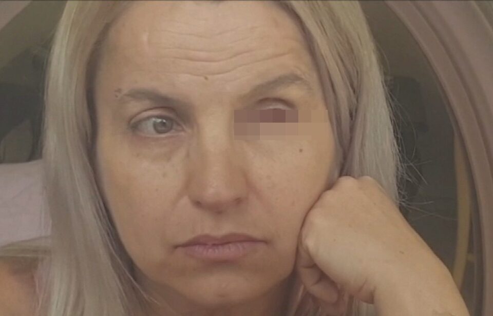 Uma empresária residente em Minaçu denuncia que ficou cega de um olho depois de passar por uma cirurgia estética nas pálpebras. (Foto: reprodução/TV Anhanguera)