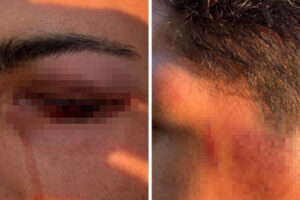 'Medo de sair de casa': Casal gay denuncia agressão durante abordagem da PM em Goiânia