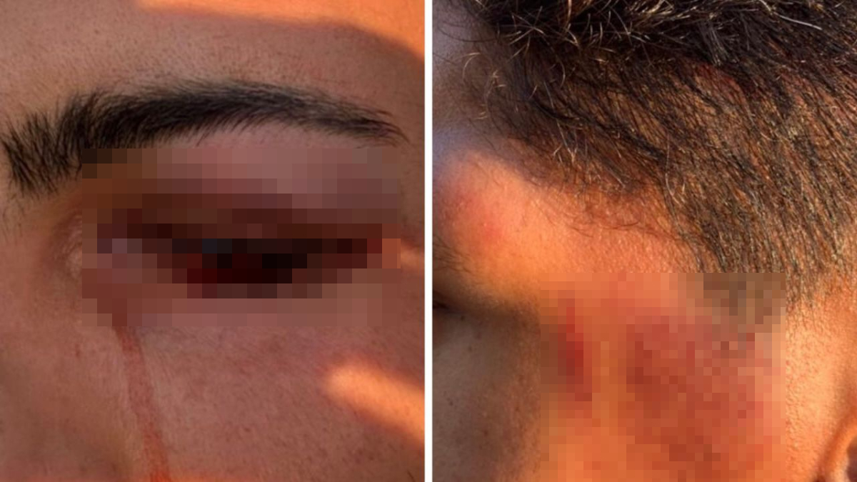 'Medo de sair de casa': Casal gay denuncia agressão durante abordagem da PM em Goiânia