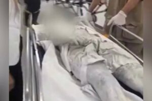 Mulher tem corpo coberto de tinta após discussão com companheiro em Goiânia (Foto: Reprodução - Redes Sociais)