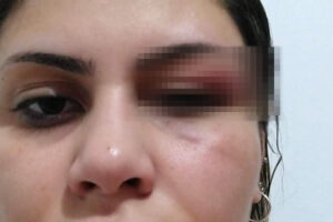 Ex-banda de músico acusado de agredir ex-mulher se manifesta sobre o caso