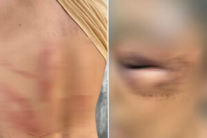 Funcionários denunciam agressões com facão durante churrasco com fazendeiro e esposa