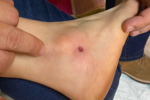 Festa de aniversário acaba com tiros disparados de prédio vizinho no Alto da Glória, em Goiânia1