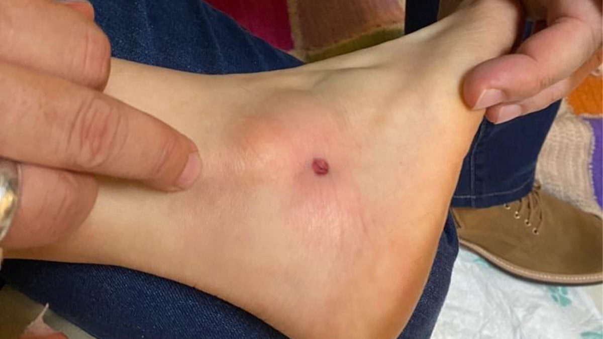 Festa de aniversário acaba com tiros disparados de prédio vizinho no Alto da Glória, em Goiânia1