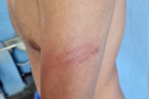 Membro do movimento ligado a população de rua diz que sua casa em Goiânia foi invadida por PMs