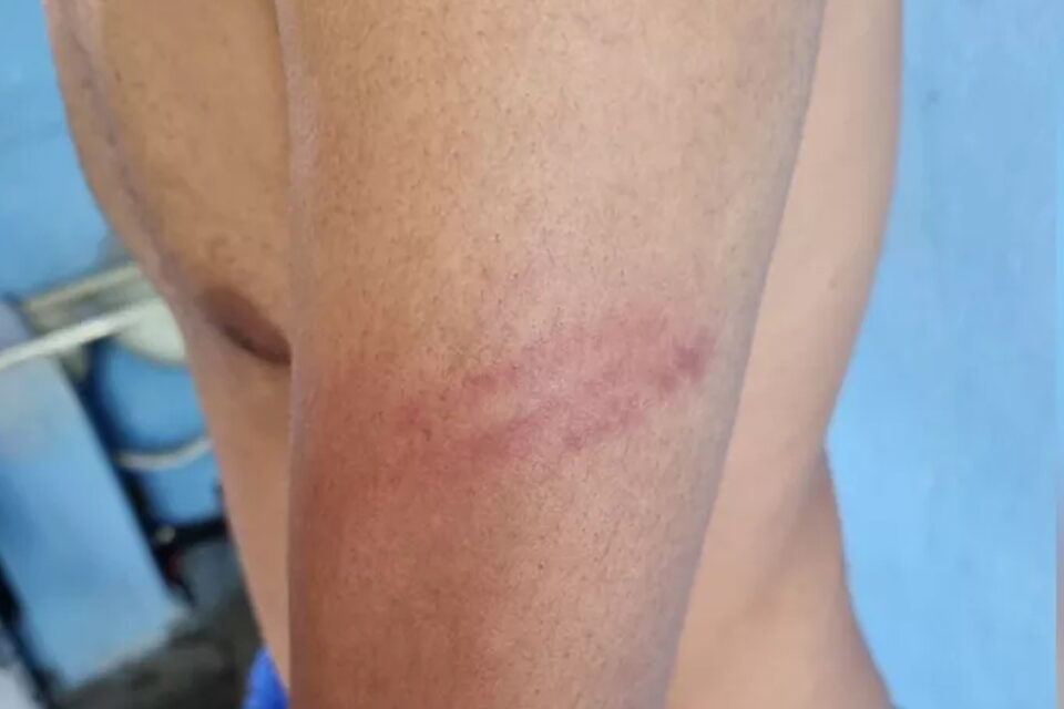 Membro do movimento ligado a população de rua diz que sua casa em Goiânia foi invadida por PMs