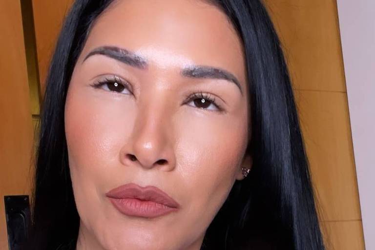 cantora simaria abelhas 'Quando o mel é bom, sempre voltam', escreveu a cantora. Simaria faz show de óculos após levar picadas de abelhas: veja foto