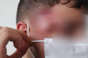 Funcionário é suspeito de agredir adolescente por ele estar parado em frente a loja