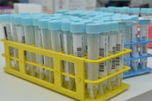 DF confirma dois casos de variante ômicron (Foto: Prefeitura de Aparecida)