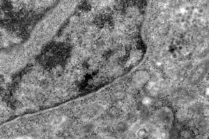 Goiás segue sem casos confirmados ou suspeitos da Ômicron