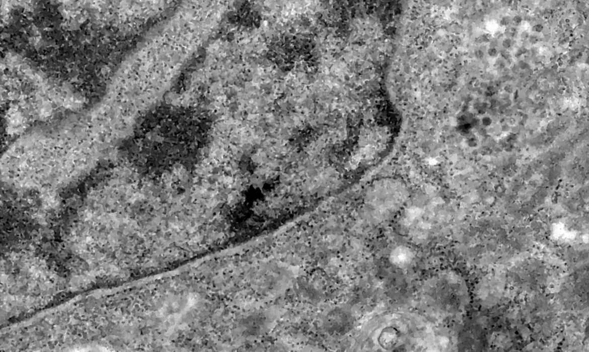 Goiás segue sem casos confirmados ou suspeitos da Ômicron