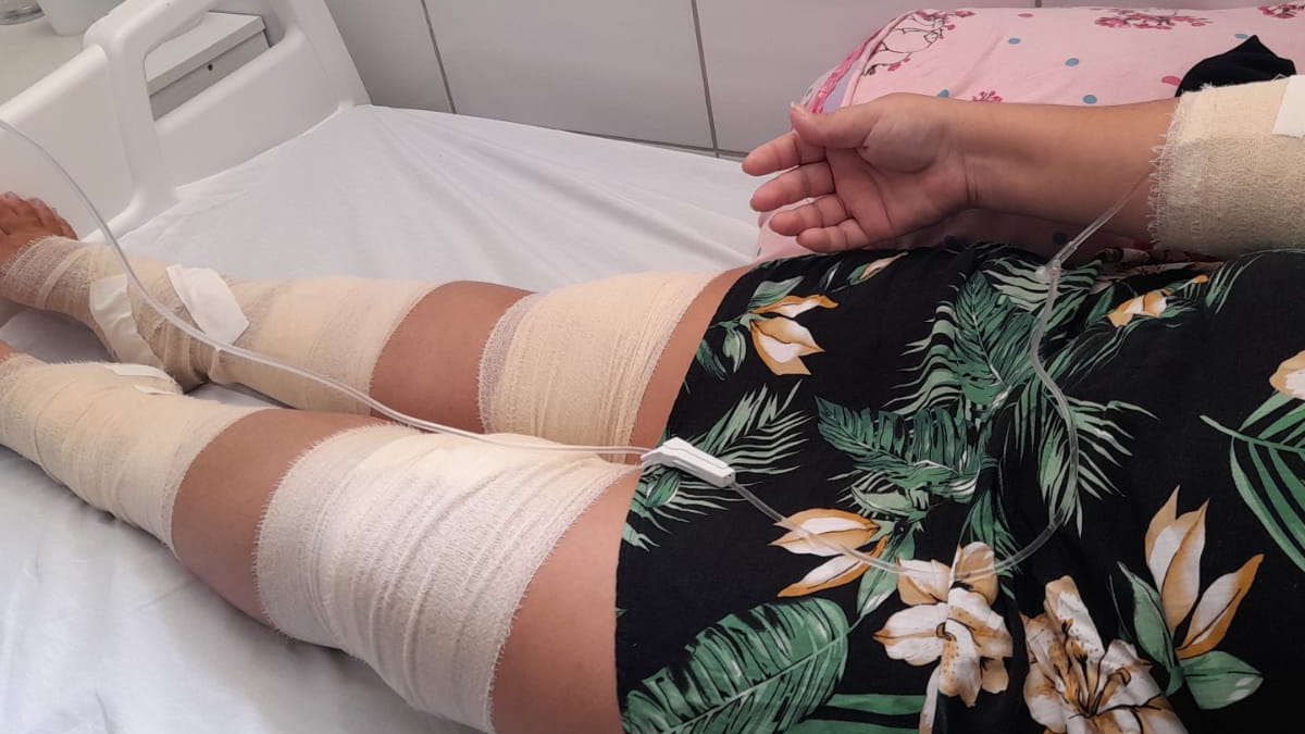 Mulher é internada após ser atacada por cães em Alexânia: veja o vídeo