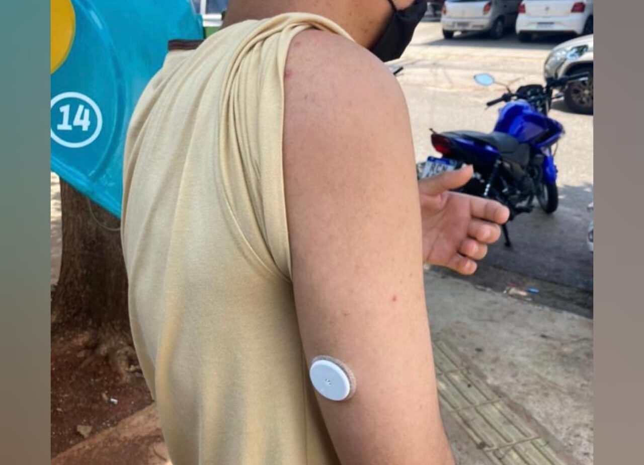 Um projeto-piloto da Secretaria Municipal de Saúde (SMS) usa sensor na pele para monitorar a glicemia de diabéticos, em Goiânia. (Foto: divulgação)