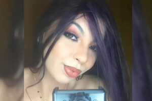 Vítima de tentativa de feminicídio em Catalão com corpo queimado deixa UTI