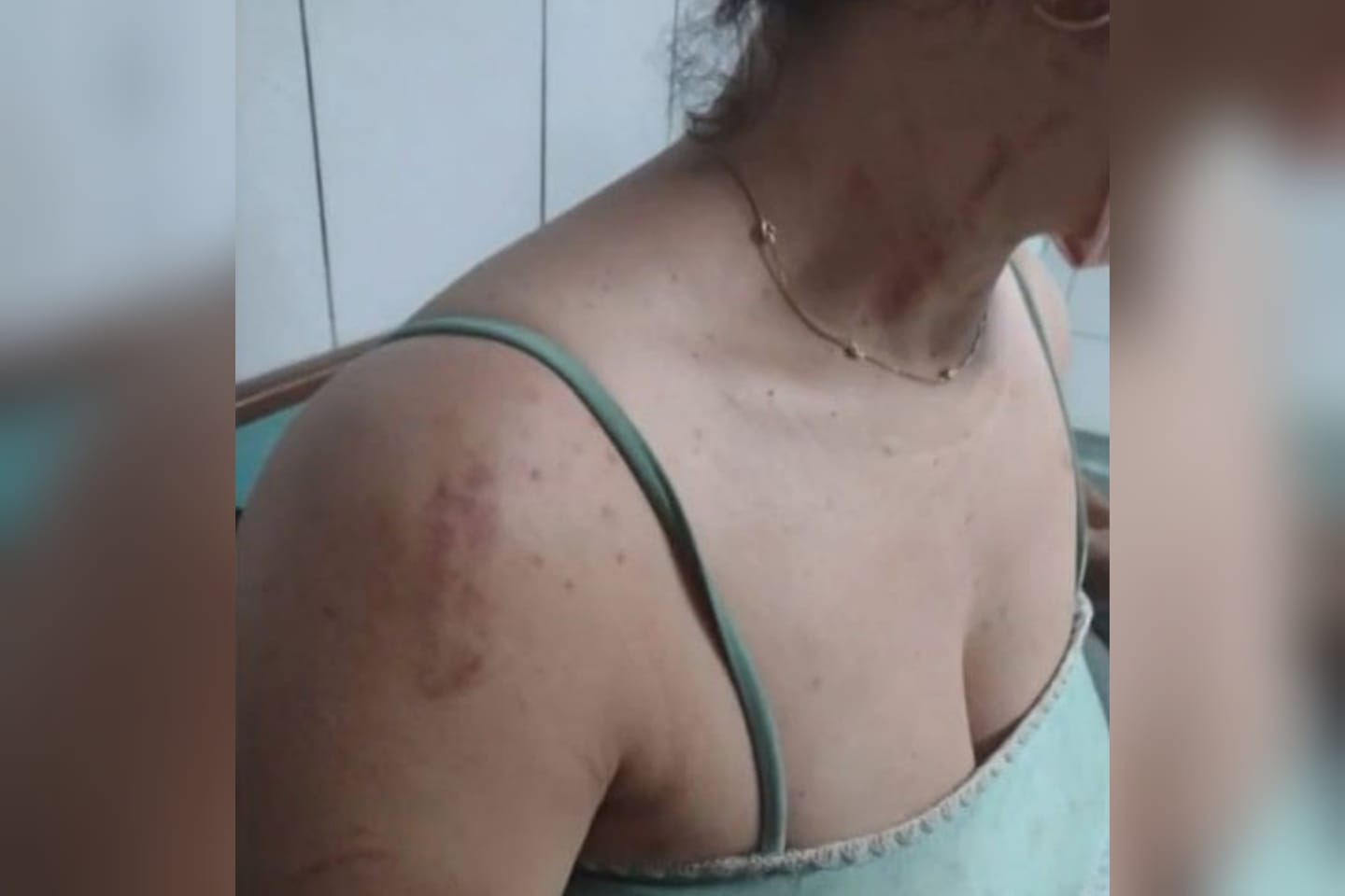 Mulher relata agressão e tortura do marido após flagrá-lo beijando outra na BA