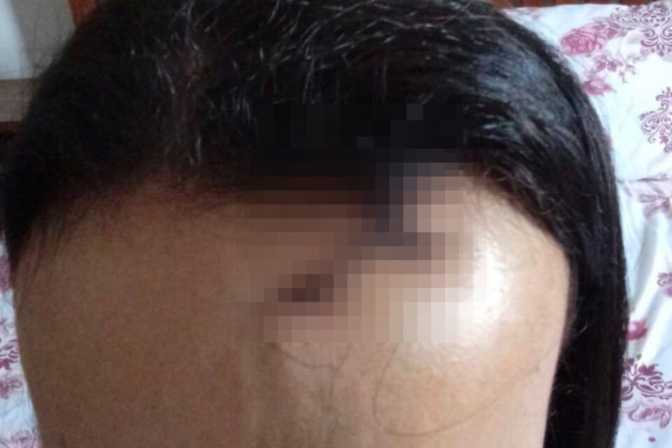 Após apoio de médicos, mulher denuncia ex-marido por agressão com chave de fenda em Jandaia (Foto: Reprodução – Arquivo Pessoal)
