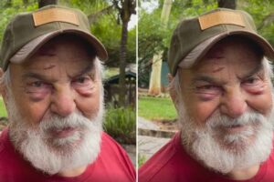 Lima Duarte machuca rosto após acidente doméstico