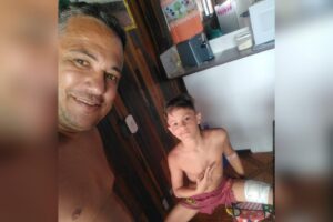 Carlos Alexandre foi atacado na perna por um tubarão no momento que estava no mar