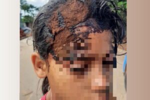 Criança sofreu corte na cabeça. (Foto: Reprodução)