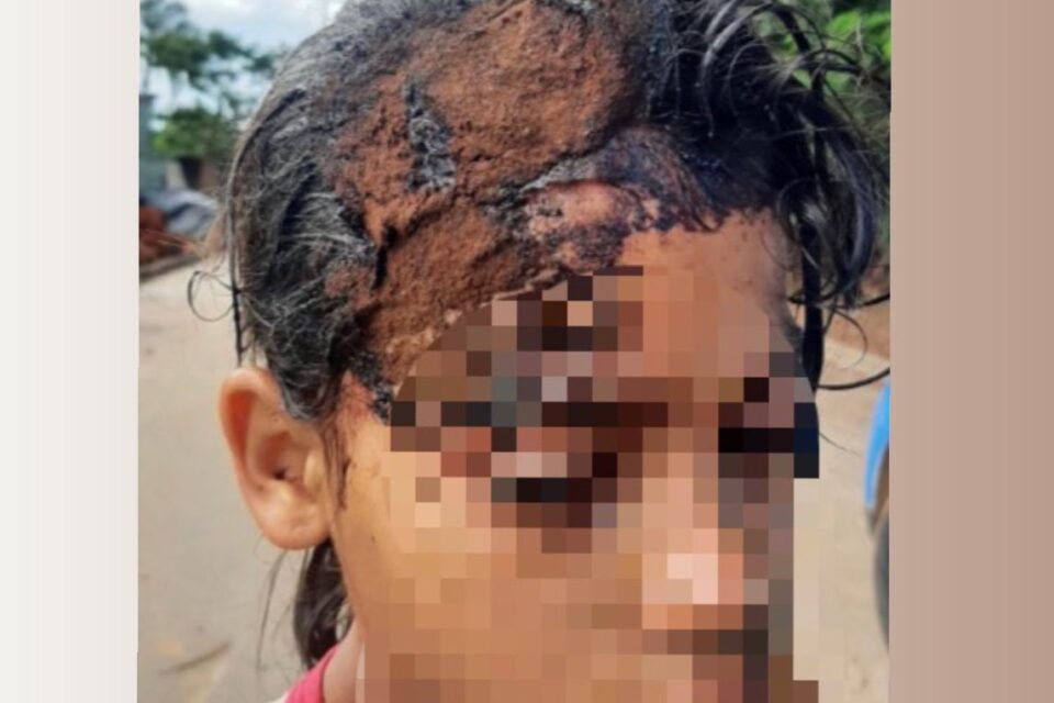 Criança sofreu corte na cabeça. (Foto: Reprodução)