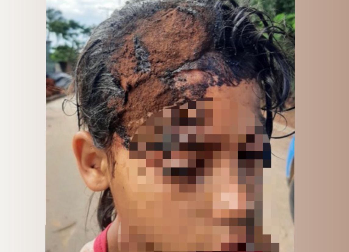 Criança sofreu corte na cabeça. (Foto: Reprodução)