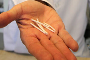 'Chip da beleza': Anvisa proíbe propaganda de produtos com gestrinona