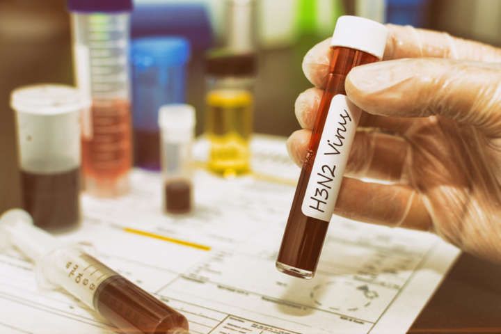 Goiânia confirmou três novos casos da gripe H3N2 e agora soma 13 registros da doença, segundo a Secretaria Municipal de Saúde.(Foto: reprodução/Catraca Livre)