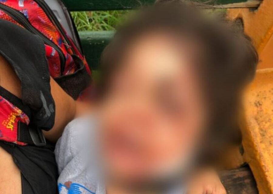 Criança de 4 anos atacada por cachorro se recupera em casa, em Goiânia